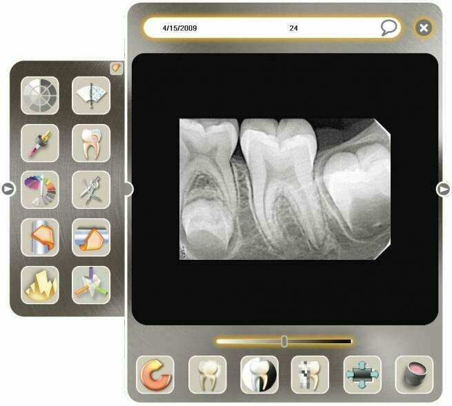 Acteon Sopro Imaging Software blaudental