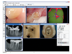 Dürr Dental DBSWIN Imaging Software | 83999