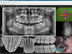 Dürr Dental VistaSoft | 83997