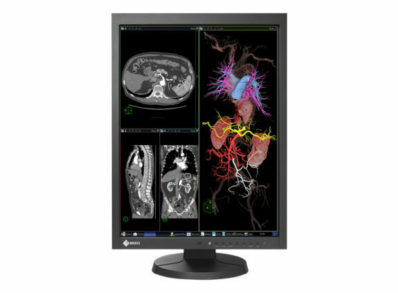 EIZO Befundungsmonitor | 84971