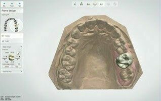 KULZER 3Shape Dental System™ CAD-Software | 83402