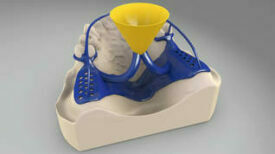 Kulzer Modellgusswachs KF Kulzer Modellgusswachs KF