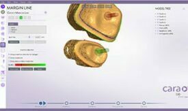 Kulzer cara CAD Software Kulzer cara CAD Software