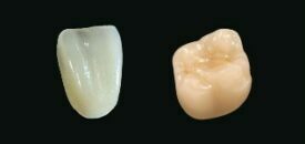 Kulzer cara LiSi2 | Werkstoffe Kulzer cara LiSi2 | Werkstoffe