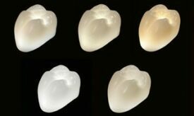 Kulzer cara Transluzentes Zirkondioxid | Werkstoffe Kulzer cara Transluzentes Zirkondioxid | Werkstoffe