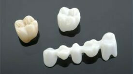 Kulzer cara Zirkondioxid | Werkstoffe Kulzer cara Zirkondioxid | Werkstoffe