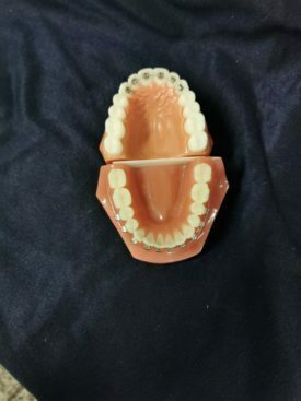 Anschauungsmodelle für KFO Anschauungsmodelle für KFO