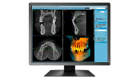 EIZO Befundungsmonitor 21 Zoll MX217-SB | 125031