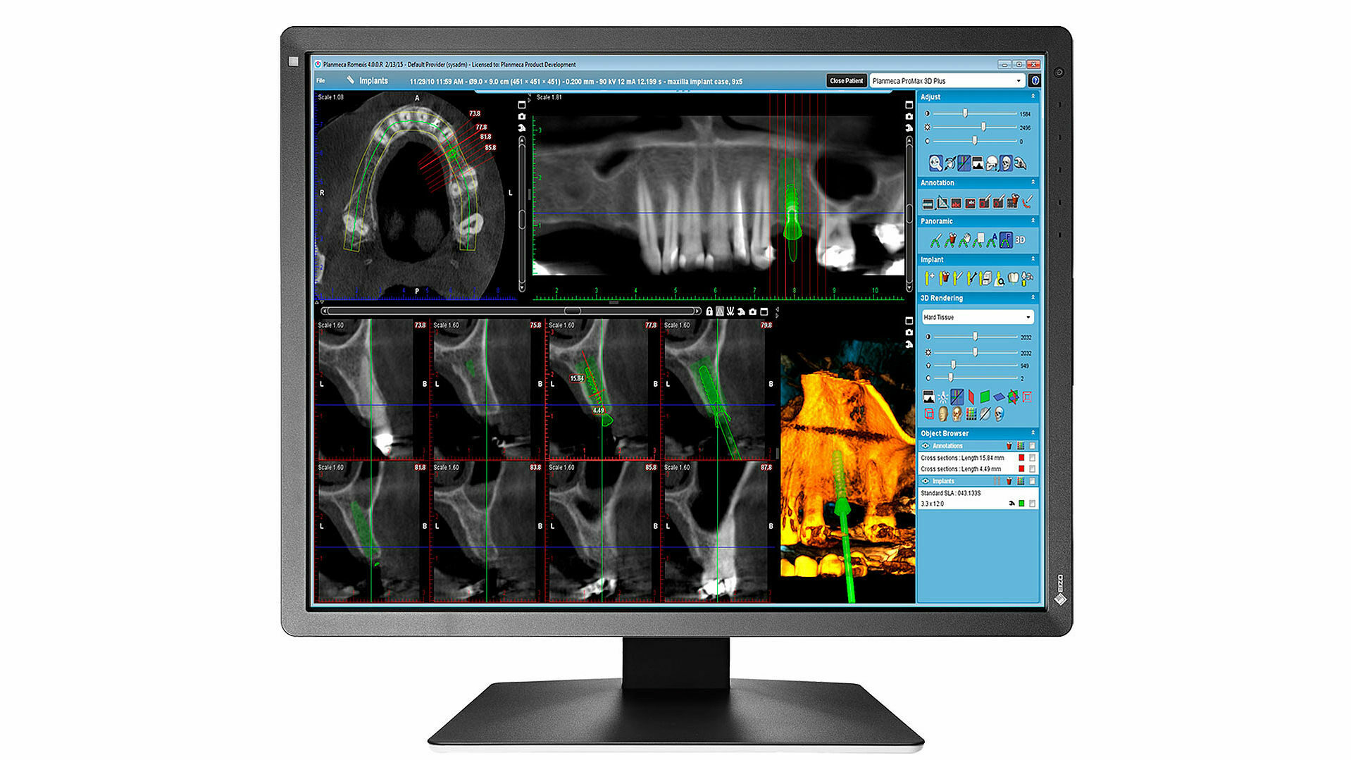 EIZO Befundungsmonitor 21 Zoll MX217-SB | 125032