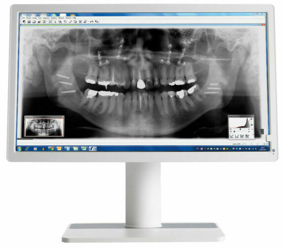 Barco Nio MDNC-2123 DE, 23,6″ Dental Befundungsmonitor Raumklasse 5 + 6 nach DIN6868-157 | 126174