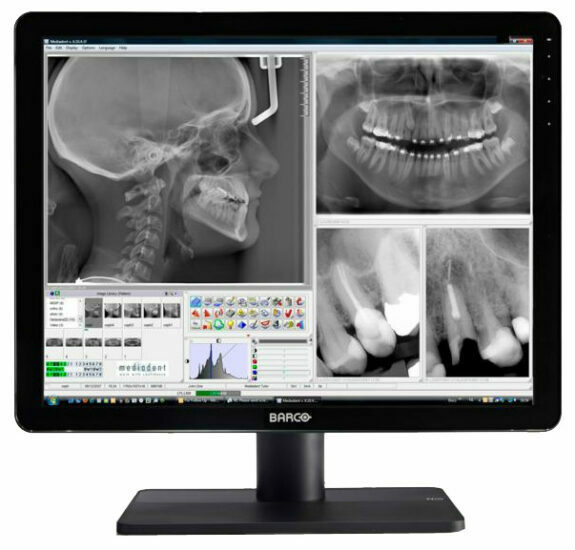 Barco Nio MDNC-3421 3MP, 21,3″ Dental Befundungsmonitor Raumklasse 5 + 6 nach DIN6868-157 | 126165