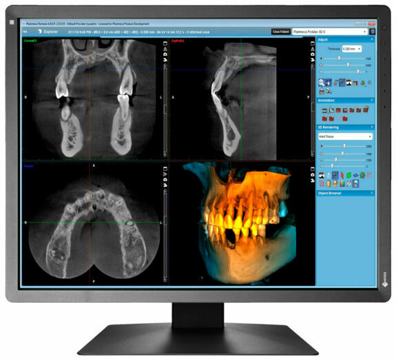 EIZO RadiForce MX216-HB 21″ dental Befundungsmonitor Raumklasse 5 + 6 nach DIN6868-157 | 126135