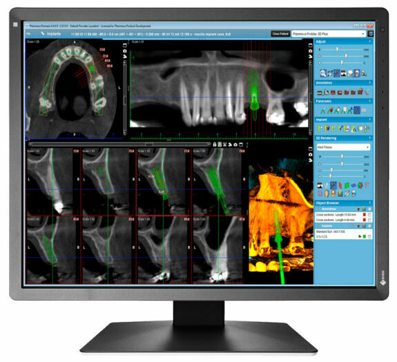 EIZO RadiForce MX216-SB 21″ dental Befundungsmonitor Raumklasse 5 nach DIN6868-157 | 126145