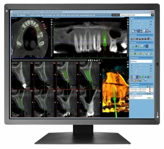 EIZO RadiForce RX250, 21,3″ Dental Befundungsmonitor Raumklasse 5 + 6 nach DIN6868-157 | 126133