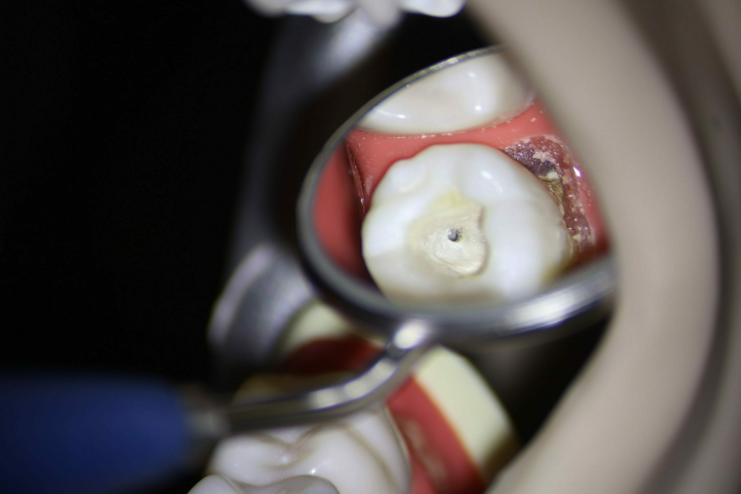 LABOMED PRIMA „lite“ Dental-Mikroskop OHNE Kamera mit Deckenmontage Aktion | 129639