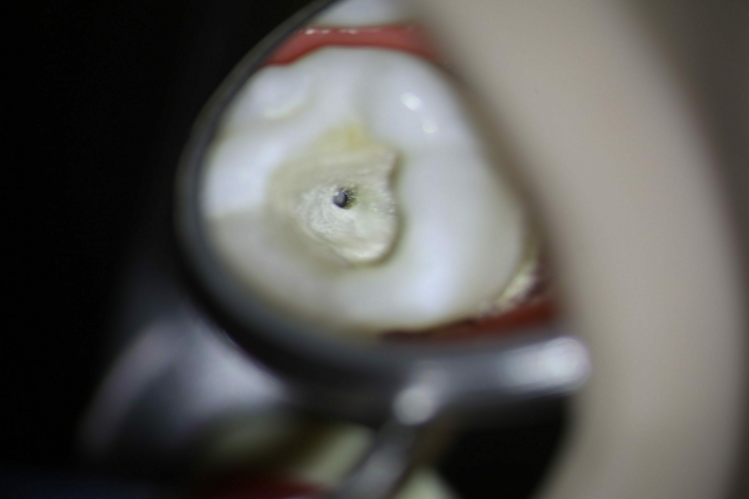 LABOMED PRIMA „lite“ Dental-Mikroskop OHNE Kamera mit Deckenmontage Aktion | 129640