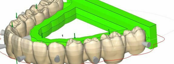 Dentale CAM Software DD smart CAM 2.0 | 129336