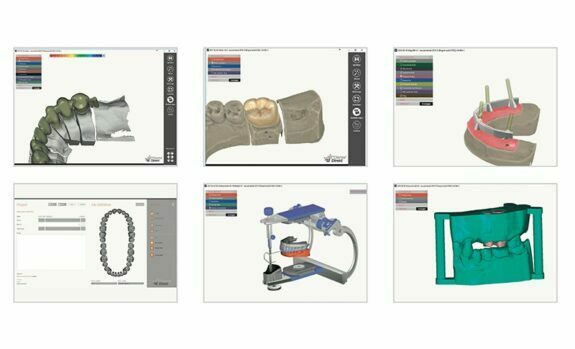CAD Software Dental Direkt designer by exocad® | 129377