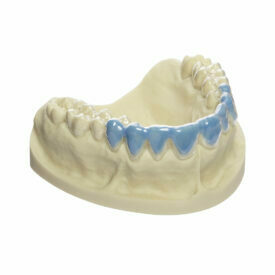 Dreve BioBleach® hart – Tiefziehfolie Dreve BioBleach® hart – Tiefziehfolie
