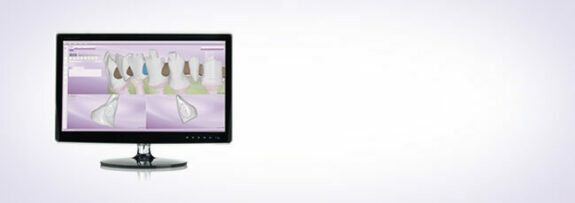 Kulzer cara Software | 145085