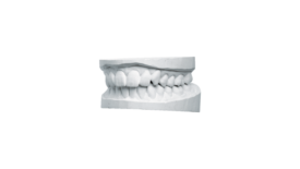 KULZER OCTA-BASTER | Alabastergips Klasse 2 KULZER OCTA-BASTER | Alabastergips Klasse 2