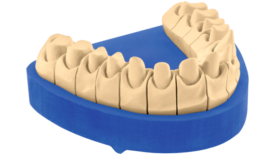 KULZER OCTA-ROCK Royal | Superhartgips, Dentalgips Klasse 4 KULZER OCTA-ROCK Royal | Superhartgips, Dentalgips Klasse 4