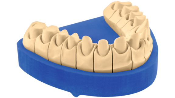 KULZER OCTA-ROCK Royal | Superhartgips, Dentalgips Klasse 4 | 146799