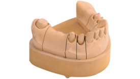 KULZER OCTA-STONE | Superhartgips, Dentalgips Klasse 4 KULZER OCTA-STONE | Superhartgips, Dentalgips Klasse 4