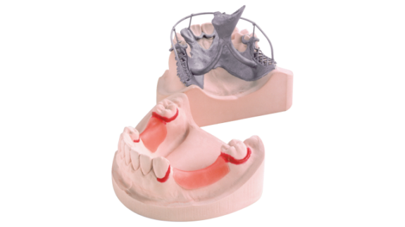 KULZER OCTA-STONE M | Superhartgips, Dentalgips Klasse 4 | 146784