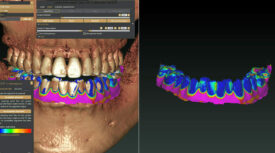 Exoplan für MORITA Implantat-Planungsprogramm Exoplan für MORITA Implantat-Planungsprogramm