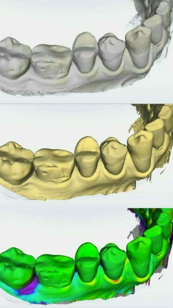 Dentsply Sirona OraCheck 5 SOFTWARE Lizenz NEU inkl. kostenlose Installation & Einweisung | 160090