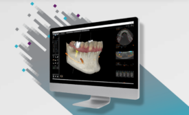 Carestream CS 3D Imaging Software Carestream CS 3D Imaging Software