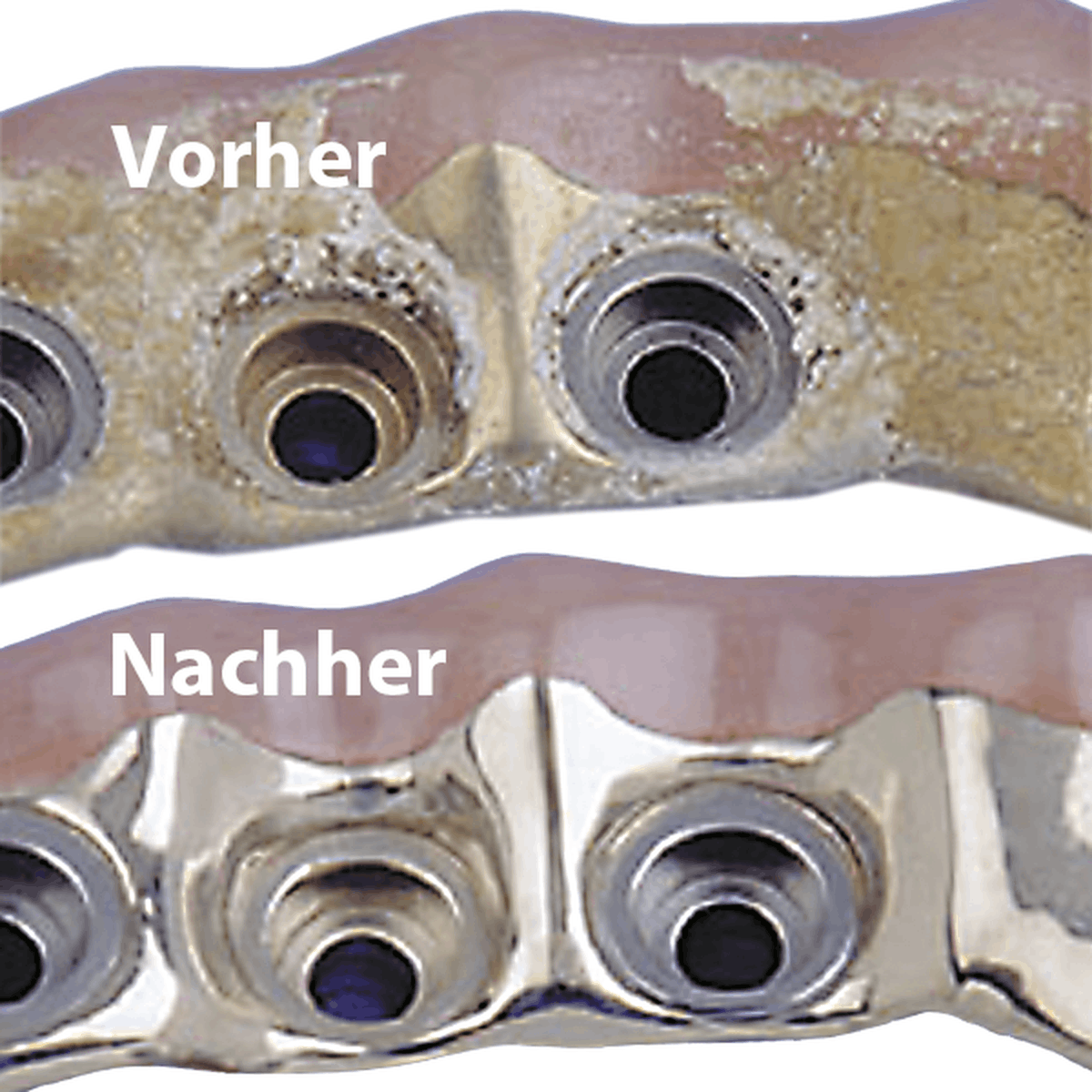 Schütz Dental Microclean | 427988