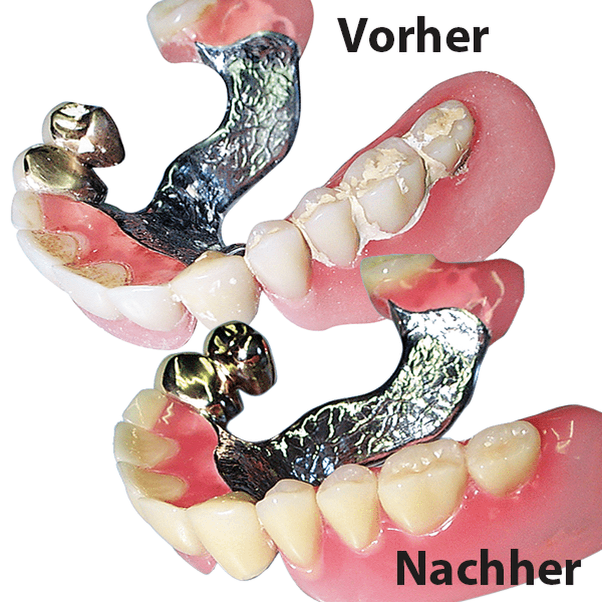 Schütz Dental Microclean | 427989
