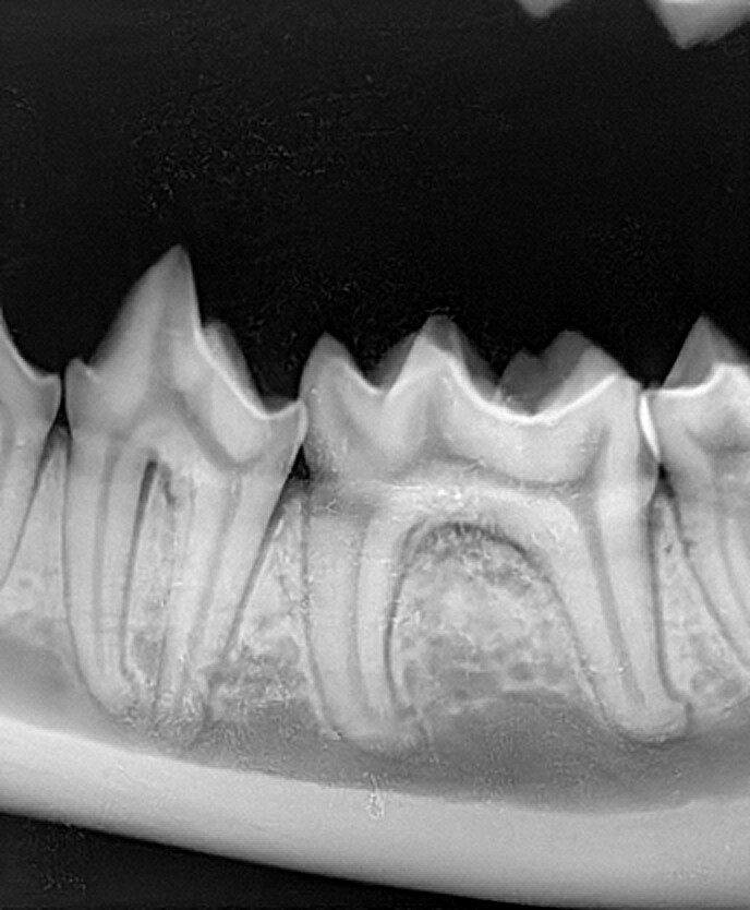 Digitaler Röntgensensor  Größe 1 20 x 30  oder 1.5 25 x 30 mm über Twain für Sidexis, Dürr ,  Kavo Cliniview usw | 182917