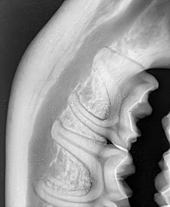 Digitaler Röntgensensor  Größe 1 20 x 30  oder 1.5 25 x 30 mm über Twain für Sidexis, Dürr ,  Kavo Cliniview usw | 182919