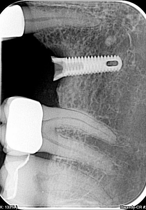 Owandy – CR ² Speicherfolienscanner USB oder Netzwerk | 182500