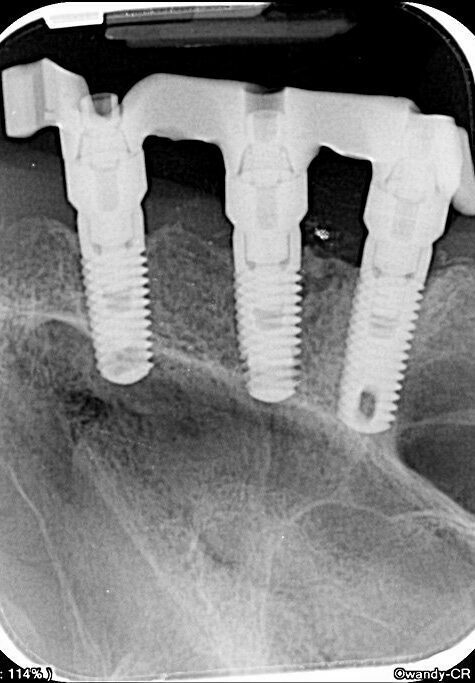 Owandy – CR ² Speicherfolienscanner USB oder Netzwerk | 182498