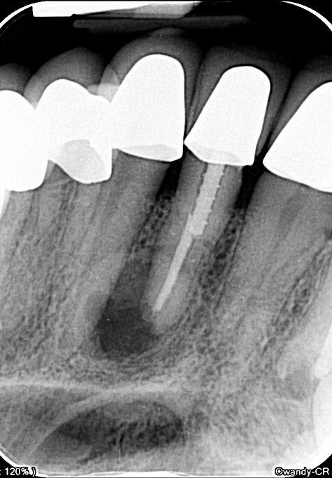 Owandy – CR ² Speicherfolienscanner USB oder Netzwerk | 182499