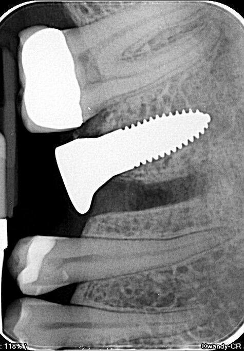 Owandy – CR ² Speicherfolienscanner USB oder Netzwerk | 182497