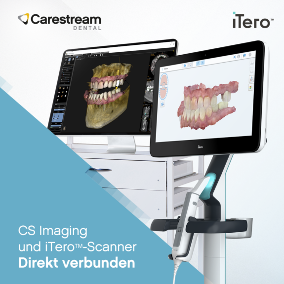 Carestream CS Imaging- und iTero-Scanner | 183530