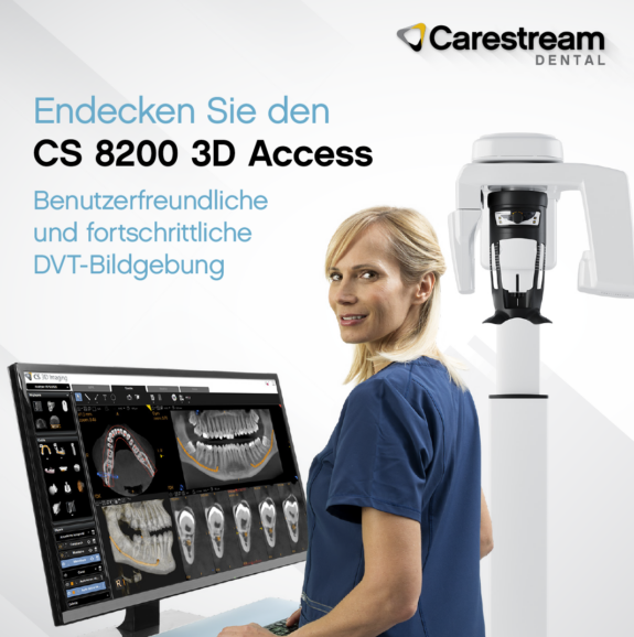 Carestream CS 8200 3D Access | 183531