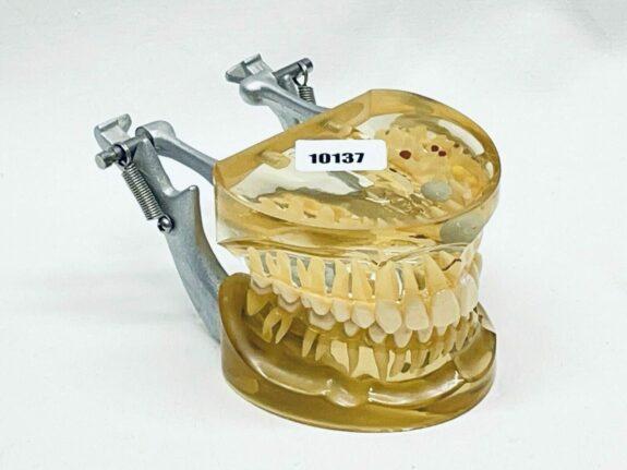 Demonstrationsmodell Zahnkrankheiten transparent  TOP | 183812