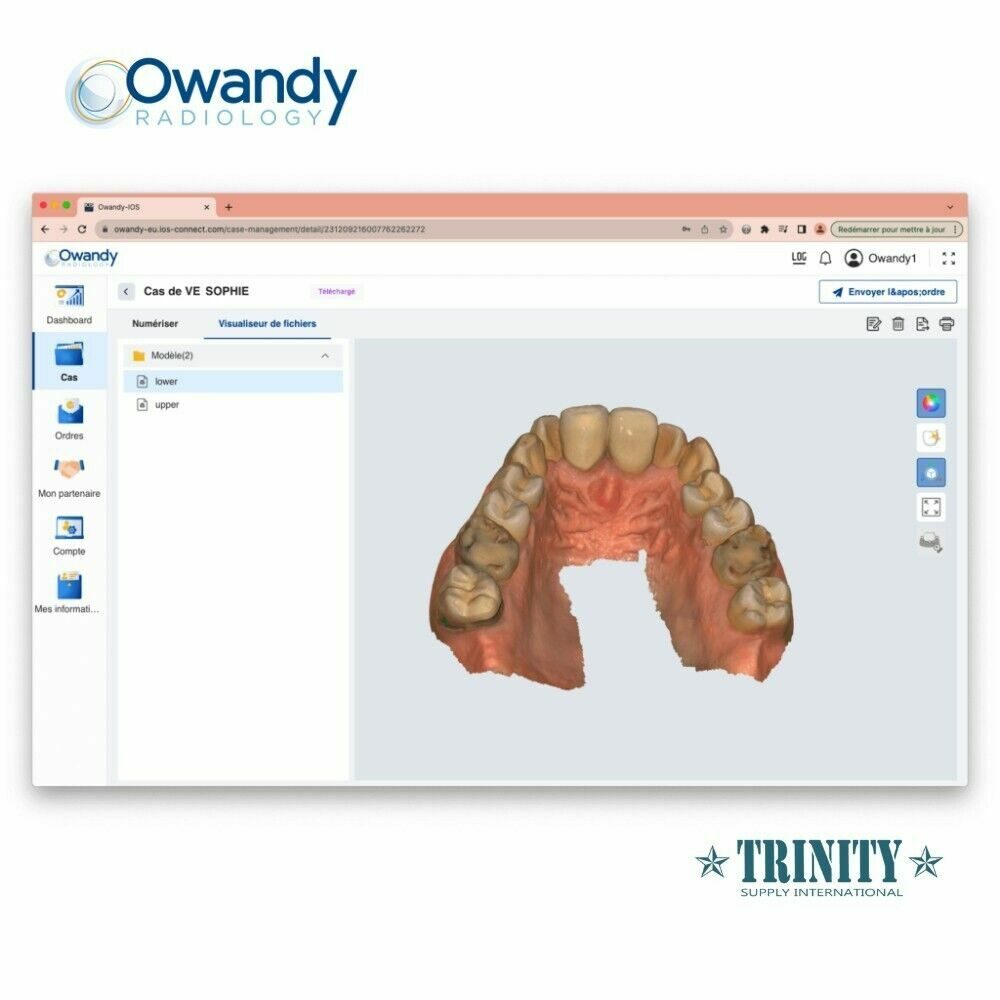Owandy IOS Intraoraler 3D Scanner Wireless | 185177