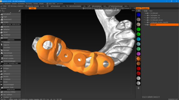 orangedental byzz® CAD | 187275