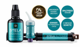 SDI Stela | Komposit SDI Stela | Komposit