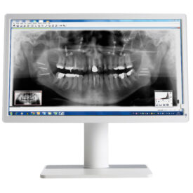 Barco Nio MDNC-2123 2MP 23,6″ Dental Befundungsmonitor Barco Nio MDNC-2123 2MP 23,6″ Dental Befundungsmonitor