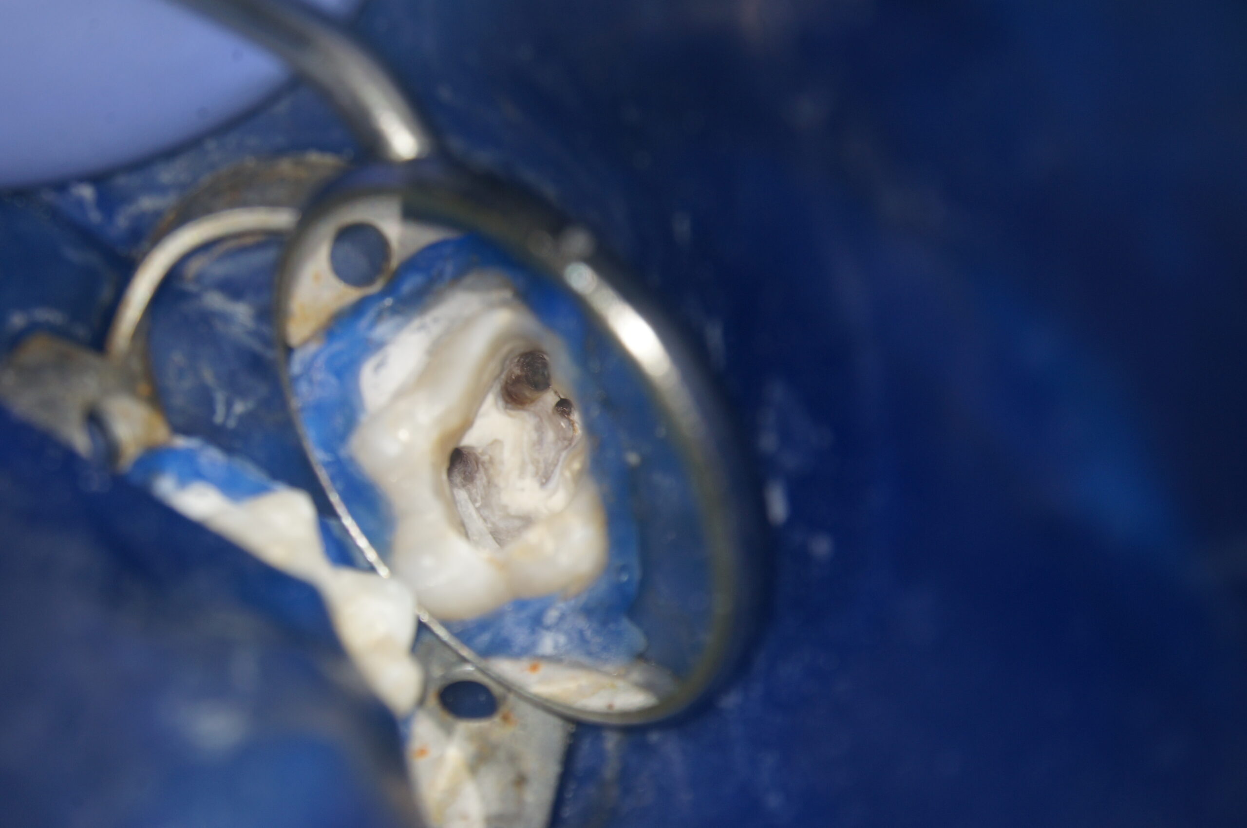 LABOMED PRIMA „pro“ Profi-Dental-Mikroskop MIT 4Kamera 200k LUX LED mit Vollausstattung! | 317505