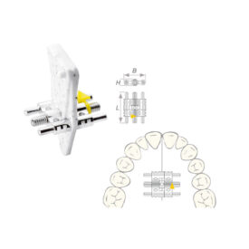 Dehnschraube Vector 200 maxi 50St Dehnschraube Vector 200 maxi 50St