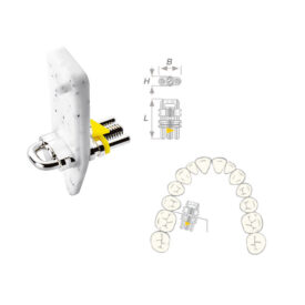 Vector 420 Sek.Dehnschraube Min50St Vector 420 Sek.Dehnschraube Min50St